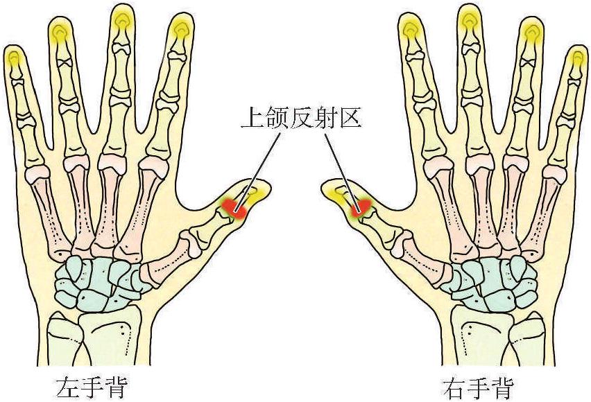 (二)口腔潰瘍